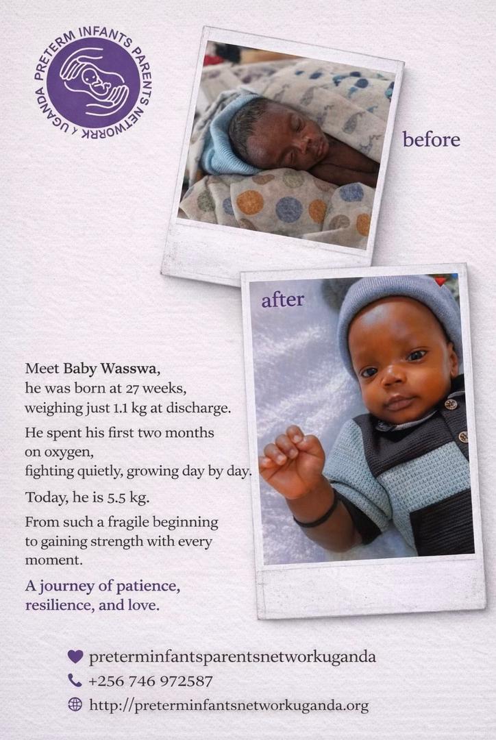 Baby Wasswa’s Journey of Hope