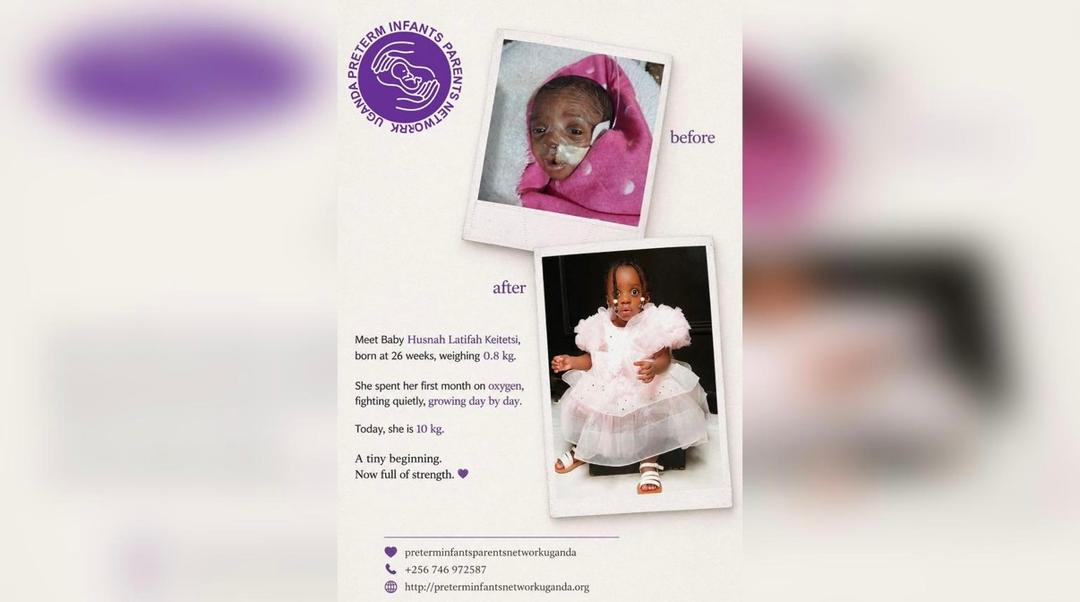 Baby Husnah’s Journey of Strength 💜