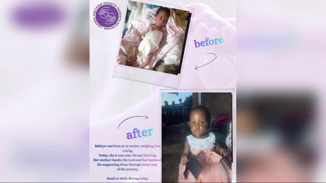 Met Our NICU Champion